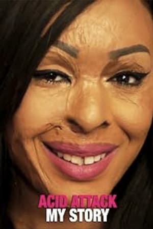 watch Acid Attack: My Story