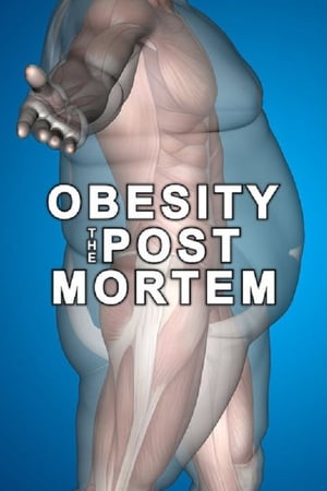 Obesity: The Post Mortem watch Obesity: The Post Mortem