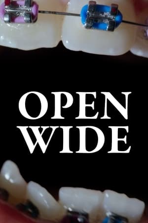 Open Wide watch Open Wide