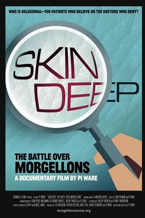 Skin Deep: The Battle Over Morgellons watch Skin Deep: The Battle Over Morgellons