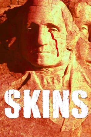 Skins watch Skins