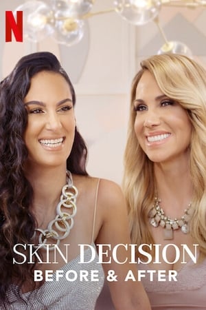 Skin Decision: Before and After Skin Decision: Before and After-hd