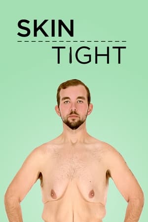 Skin Tight-hd